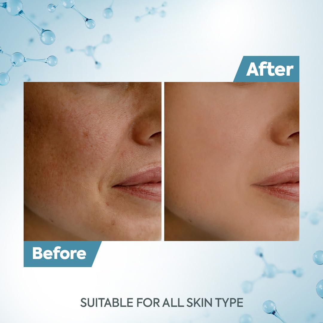 Raaga Professional De-Tan Pack with Kojic, Lactic Acid & Arbutin | Tan Removal Cream | Dermatologically Tested, Peroxide, Hydroquinone & Sulphate Free Face Pack- 500g