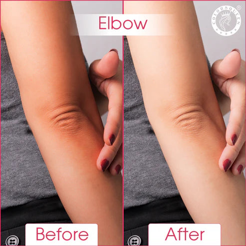 Colors Queen Body & Private Parts Whitening Cream