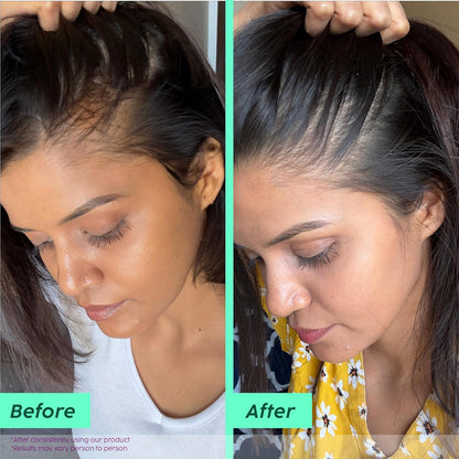 The Plant Fix Plix Rosemary Advanced Anti HairFall Shampoo for Decreases Hair Fall & Breakage - 200 ml | All Hair Types | Men & Women | Sulphate & Paraben Free